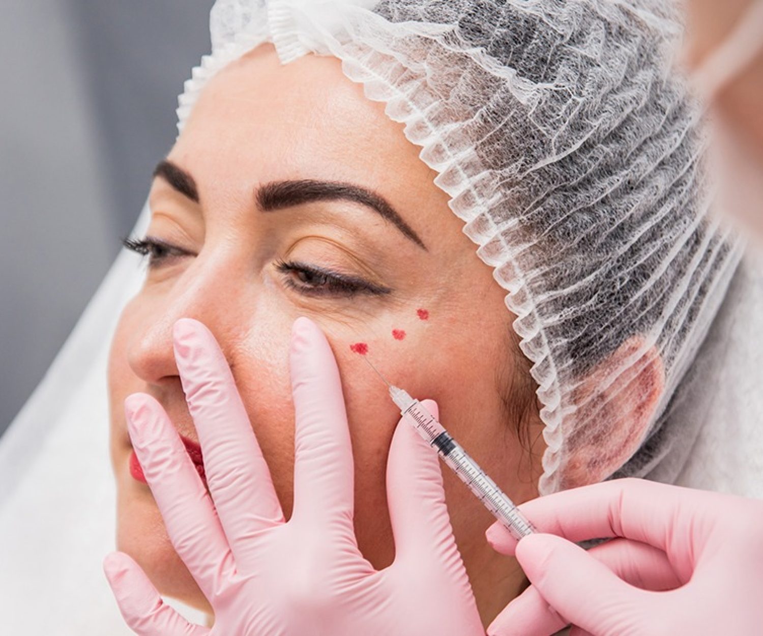 Dermal fillers New Jersey